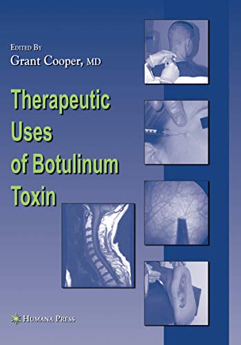 Beispielbild fr Therapeutic Uses of Botulinum Toxin zum Verkauf von Blackwell's