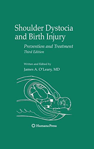 9781617379277: Shoulder Dystocia and Birth Injury: Prevention and Treatment