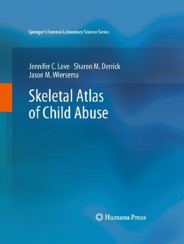 9781617792151: Skeletal Atlas of Child Abuse