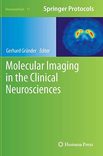 9781617799884: Molecular Imaging in the Clinical Neurosciences: 71 (Neuromethods)