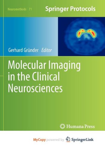 9781617799907: Molecular Imaging in the Clinical Neurosciences