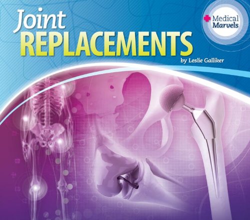 9781617839030: Joint Replacements