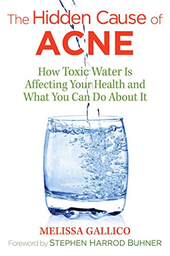 9781620557099: The Hidden Cause of Acne: How Toxic Water Is Affecting Your Health and What You Can Do about It