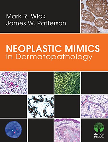 Imagen de archivo de Neoplastic Mimics in Dermatopathology (Pathology of Neoplastic Mimics) a la venta por GoldenWavesOfBooks