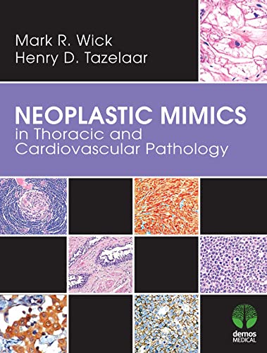 Imagen de archivo de Neoplastic Mimics in Thoracic and Cardiovascular Pathology (Pathology of Neoplastic Mimics) a la venta por suffolkbooks