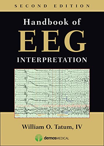 9781620700167: Handbook of EEG Interpretation