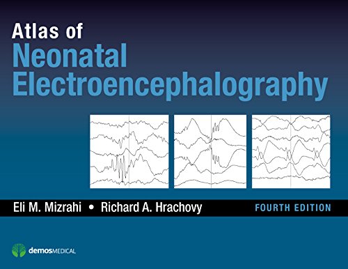 9781620700679: Atlas of Neonatal Electroencephalography