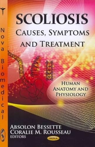 9781620810071: Scoliosis: Causes, Symptoms & Treatment (Human Anatomy and Physiology)