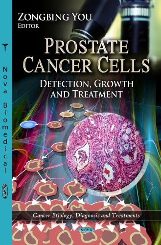 9781622575251: PROSTATE CANCER CELLS: Detection, Growth & Treatment (Cancer Etiology, Diagnosis and Treatments)