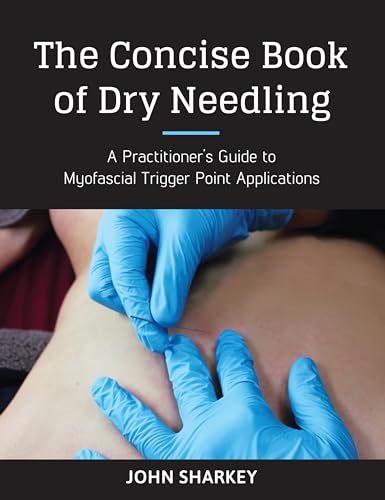 9781623170837: The Concise Book of Dry Needling: A Practitioner's Guide to Myofascial Trigger Point Applications