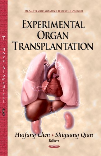 Imagen de archivo de Experimental Organ Transplantation a la venta por ThriftBooks-Atlanta