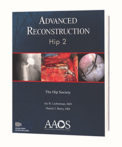 9781625525574: Advanced Reconstruction Hip