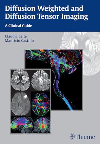 9781626230217: Diffusion Weighted and Diffusion Tensor Imaging: A Clinical Guide
