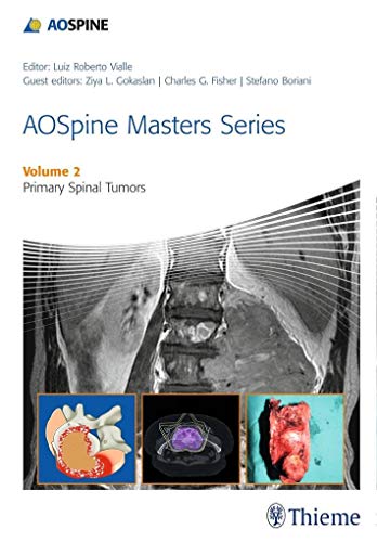 Beispielbild fr AOSpine Masters Series Volume 2: Primary Spinal Tumors zum Verkauf von THE SAINT BOOKSTORE