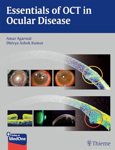 Stock image for Essentials of OCT in Ocular Disease for sale by Books From California