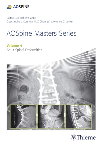 9781626231009: AOSpine Master Series, Vol. 4: Adult Spinal Deformities (AOSpine Masters Series)