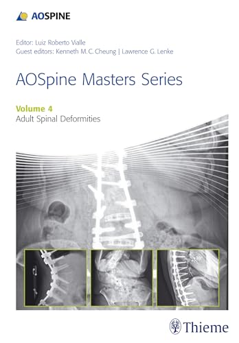 Imagen de archivo de Aospine Masters Series: Adult Spinal Deformities (Volume 4) a la venta por Anybook.com