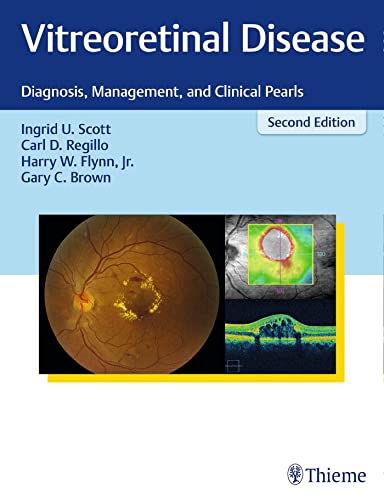 Stock image for Vitreoretinal Disease: Diagnosis, Management, and Clinical Pearls for sale by HPB-Red