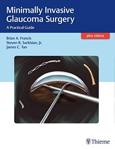 Stock image for Minimally Invasive Glaucoma Surgery for sale by Blackwell's