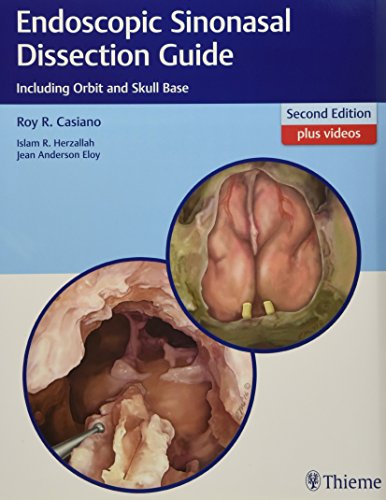 9781626232105: Endoscopic Sinonasal Dissection Guide: Including Orbit and Skull Base