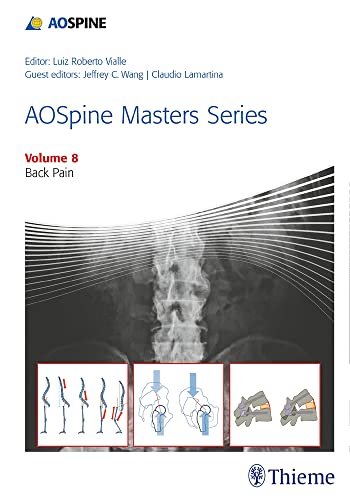 Beispielbild fr AOSpine Masters Series, Volume 8: Back Pain zum Verkauf von Bestsellersuk