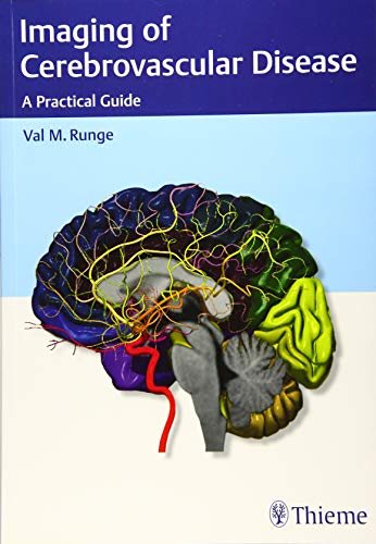 Stock image for Imaging of Cerebrovascular Disease for sale by Blackwell's