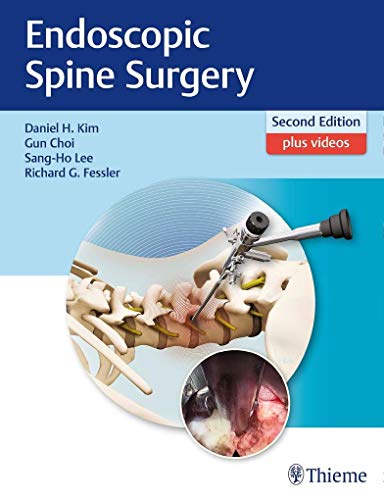 9781626232648: Endoscopic Spine Surgery