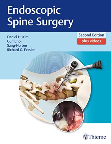 Stock image for Endoscopic Spine Surgery for sale by Revaluation Books