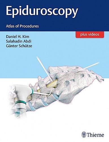 Stock image for Epiduroscopy: Atlas of Procedures - 1E for sale by Books Puddle