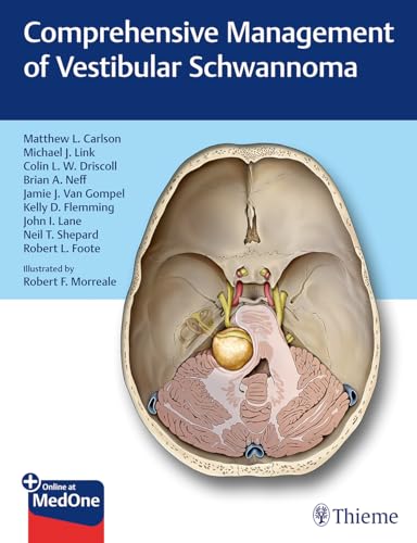 Beispielbild fr Comprehensive Management of Vestibular Schwannoma zum Verkauf von BooksRun
