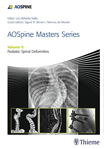 9781626234536: AOSpine Masters Series, Volume 9: Pediatric Spinal Deformities xyz