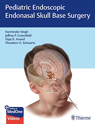 Imagen de archivo de Pediatric Endoscopic Endonasal Skull Base Surgery a la venta por Blackwell's