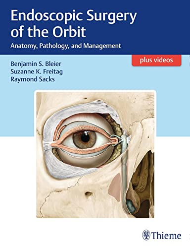 Stock image for Endoscopic Surgery of the Orbit for sale by Blackwell's