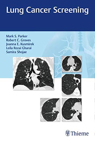 Beispielbild fr Lung Cancer Screening zum Verkauf von Books From California