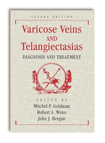 9781626235489: Varicose Veins and Telangiectasias: Diagnosis and Treatment