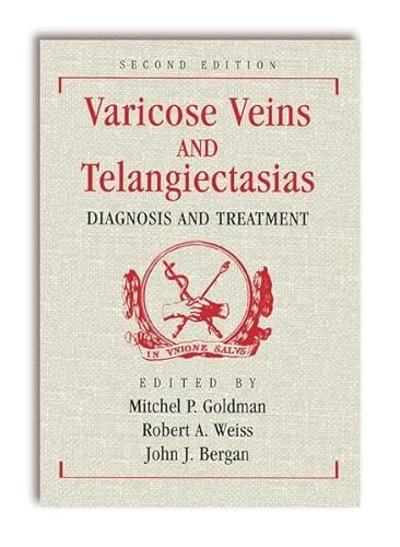 Stock image for Varicose Veins and Telangiectasias: Diagnosis and Treatment for sale by Books Puddle