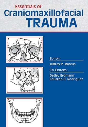 9781626235595: Essentials of Craniomaxillofacial Trauma