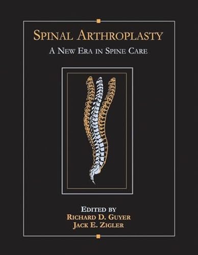 Imagen de archivo de Spinal Arthroplasty: A New Era in Spine Care a la venta por Books Puddle