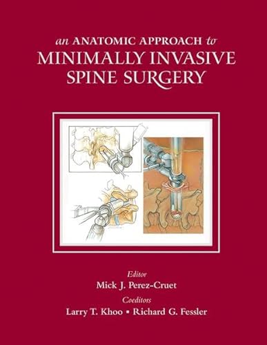 9781626236424: An Anatomic Approach to Minimally Invasive Spine Surgery