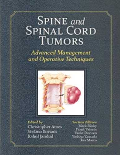 Beispielbild fr Spine and Spinal Cord Tumors: Advanced Management and Operative Techniques zum Verkauf von Mispah books