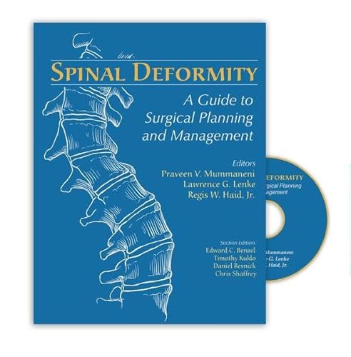 Beispielbild fr Spinal Deformity: A Guide to Surgical Planning and Management zum Verkauf von dsmbooks