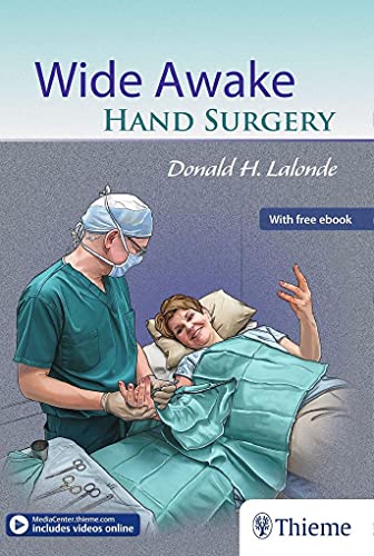 Imagen de archivo de Wide Awake Hand Surgery a la venta por Books Puddle