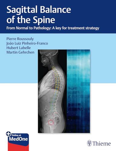 Stock image for Sagittal Balance of the Spine: From Normal to Pathology: A Key for Treatment Strategy [Hardcover] Roussouly, Pierre; Pinheiro-Franco, Joo Luiz; Labelle, Hubert and Gehrchen, Martin for sale by Brook Bookstore