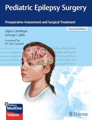 Stock image for Pediatric Epilepsy Surgery: Preoperative Assessment and Surgical Treatment for sale by BooksRun