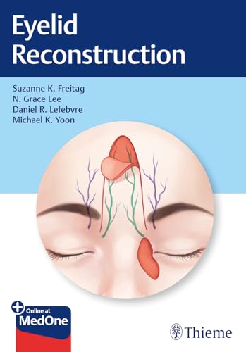 Stock image for Eyelid Reconstruction for sale by GF Books, Inc.