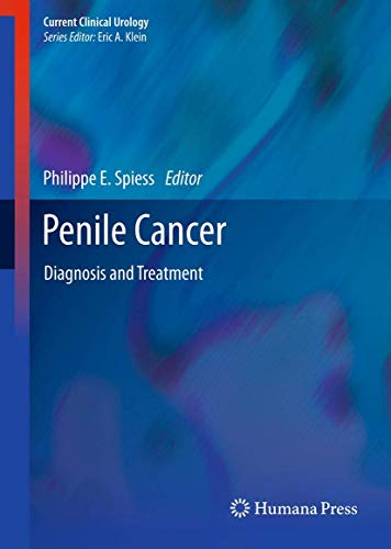 Beispielbild fr Penile Cancer : Diagnosis and Treatment zum Verkauf von Buchpark