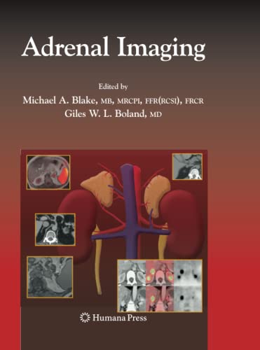 Stock image for Adrenal Imaging (Contemporary Medical Imaging) for sale by GF Books, Inc.