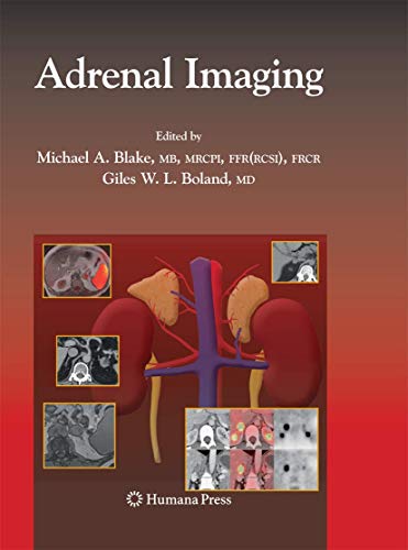 9781627038577: Adrenal Imaging (Contemporary Medical Imaging)