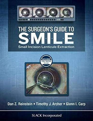 Stock image for The Surgeons Guide to SMILE: Small Incision Lenticule Extraction for sale by BooksRun