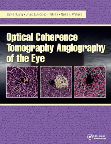 Stock image for Optical Coherence Tomography Angiography of the Eye: OCT Angiography for sale by HPB-Red